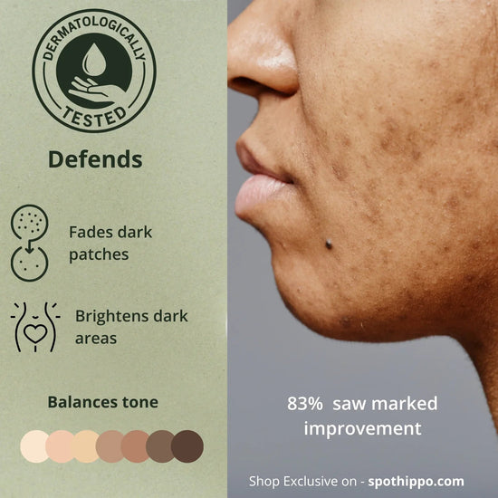 Whitening Serum   spothippo