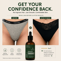 Aftershave-Ingrown Hair Oil - spothippo