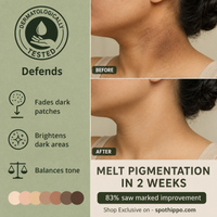Depigmentation Solution