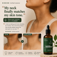 Depigmentation Solution