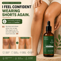 Depigmentation Solution