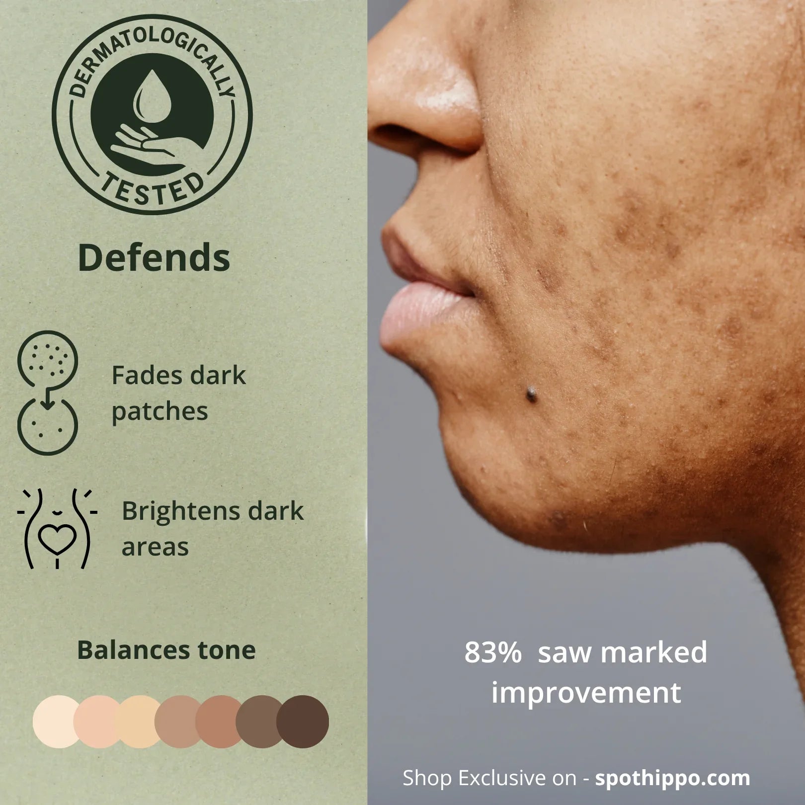 dermatologically tested Whitening Serum infographics spothippo
